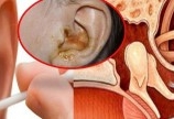Các tác hại của việc đeo tai nghe quá nhiều ! Sử dụng sao cho hiệu quả 